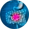 NYC Crohn’s Disease Specialist Doctor / Gastroenterologist