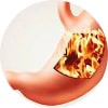 Gastritis Specialist Doctor NYC