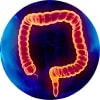NYC Rectal Bleeding  Treatment, Best Rated Anus Bleeding Specialist