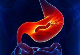 H Pylori