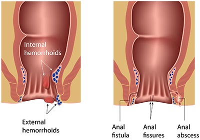 Clit g spot vibes