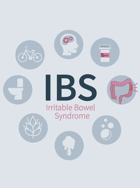 Irritable Bowel Syndrome