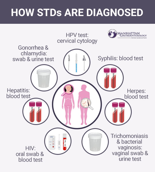 How STDs Are Diagnosed