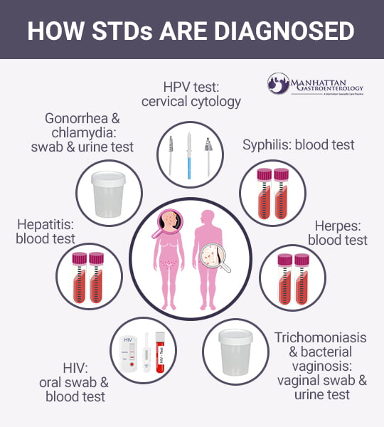 chlamydia std