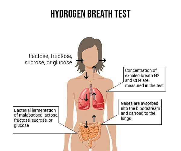 Hydrogen Breath Test