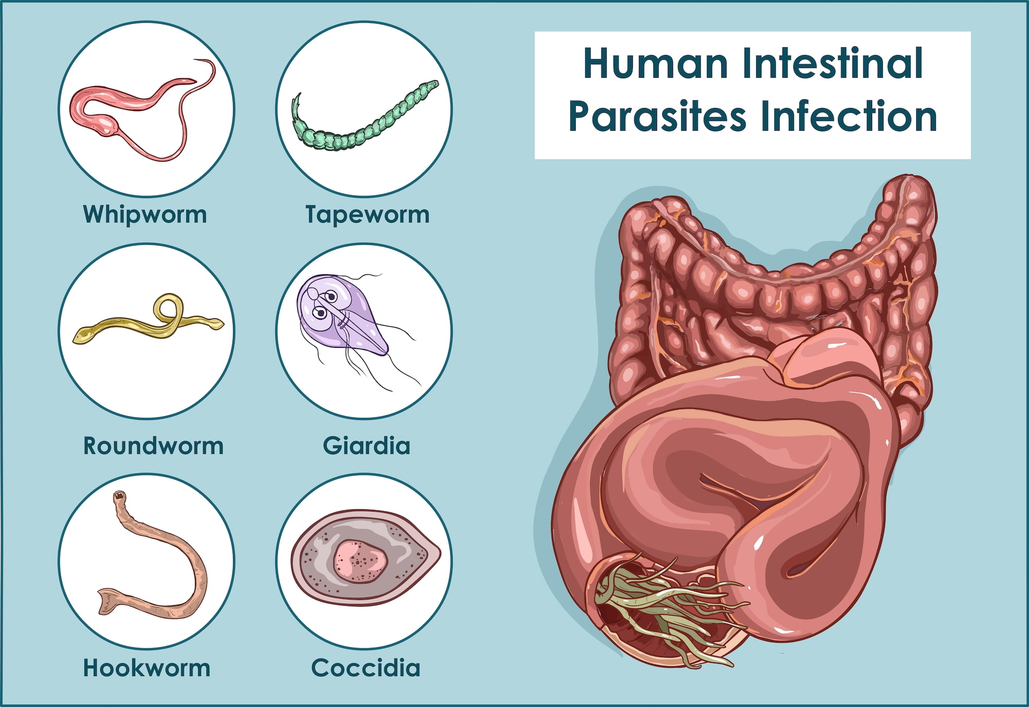 Human Intestinal Parasites Infection