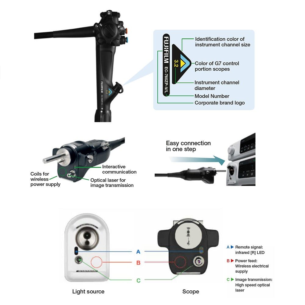 Endoscopic Imaging System