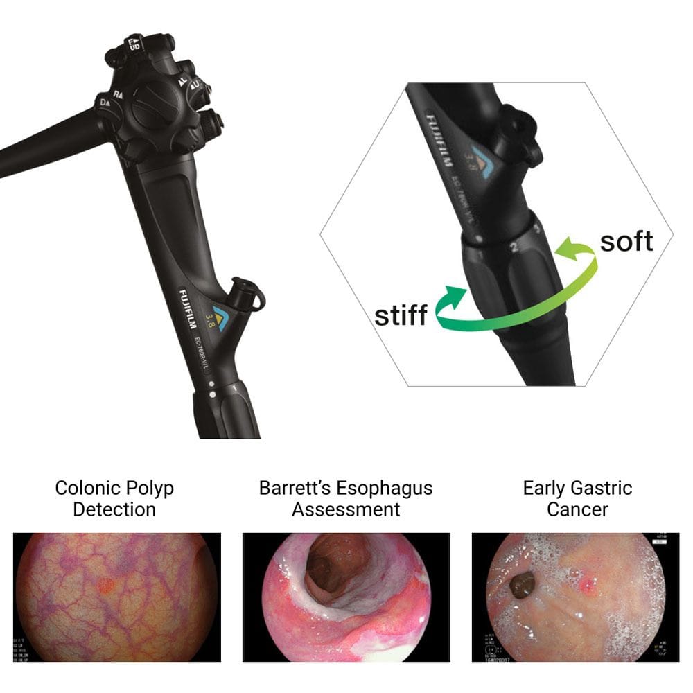 Increase Diagnostic Confidence with LCI