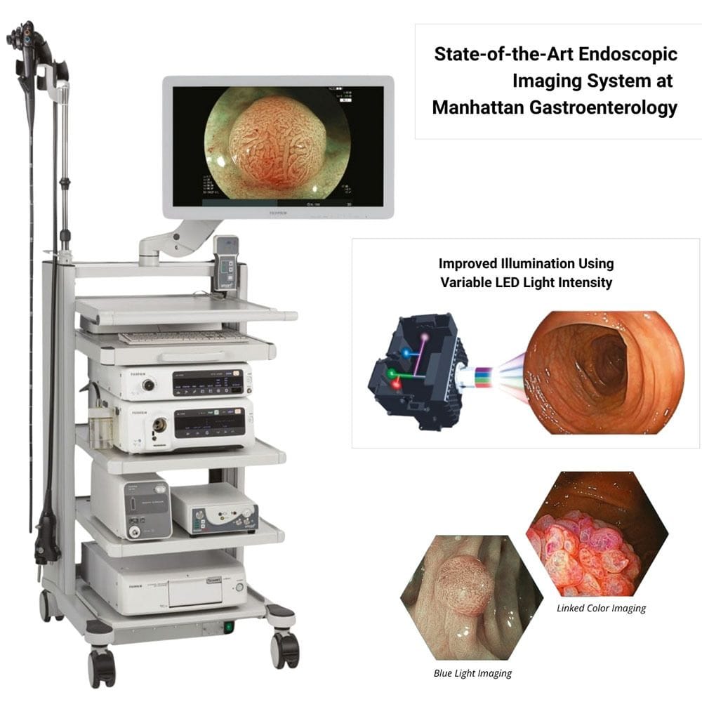 State of The Art Endoscopic Imaging System at Manhattan Gastroenterology